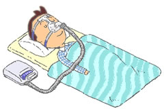4.シリーズ最終号は睡眠時無呼吸症候群(SAS)の治療です