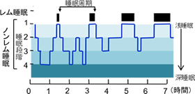 Q＆A　質の良い睡眠とは？